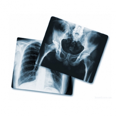 
Пленка MXB Medical X-Ray Film - синечувствительная пленка для рутинных рентгенологических исследований
