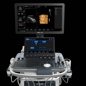 Zoncare ViV 60 Цифровой стационарный УЗИ-сканер с цветным, энергетическим, импульсным и постоянным допплером Zoncare ViV 60 Цифровой стационарный УЗИ-сканер с цветным, энергетическим, импульсным и постоянным допплером